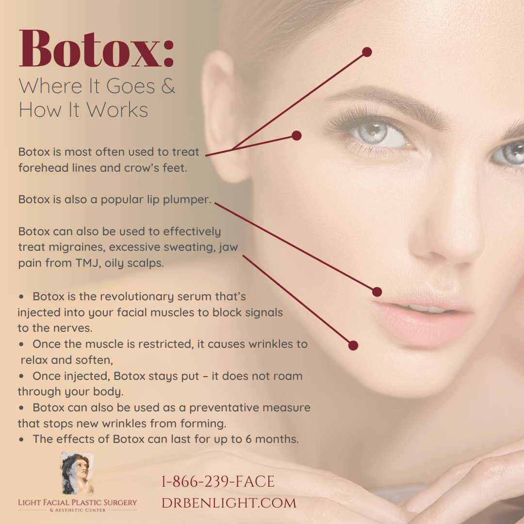 How Botox work